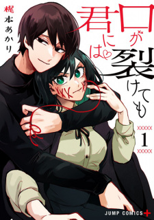 Kuchi ga Saketemo Kimi ni wa comic
